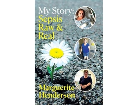 Livro My Story Sepsis Raw And Real De Marguerite Henderson (inglês)