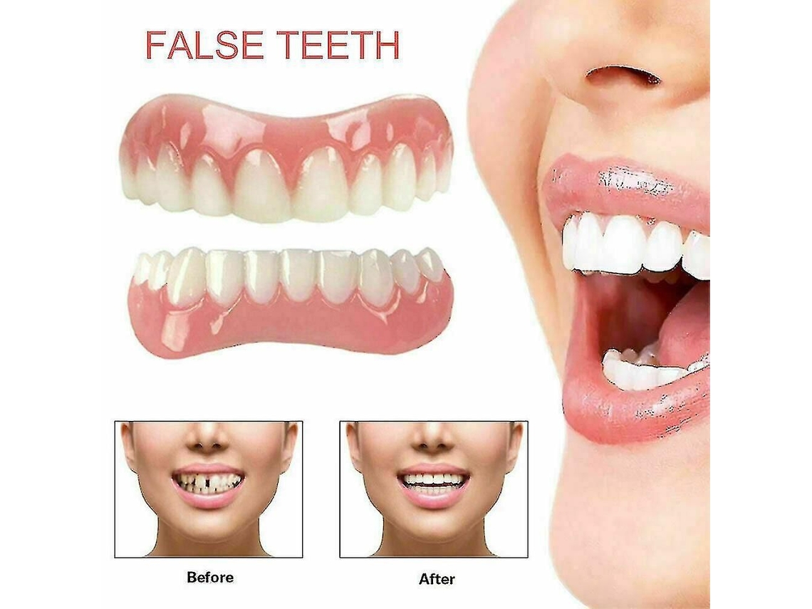 Facetas Dentárias de Alta Qualidade, Encaixe Instantâneo