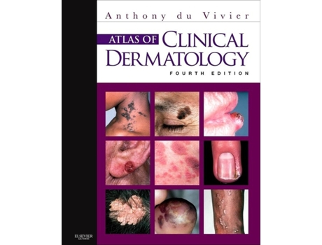 Livro Atlas Of Clinical Dermatology de Anthony Du Vivier (Inglés)