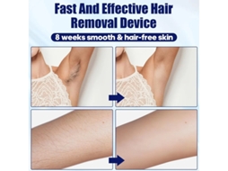 Depilador Facial Portátil Para Homens E Mulheres Sistema De Depilação Ice Atualizado Com Compressa De Gelo Branco Yizhood