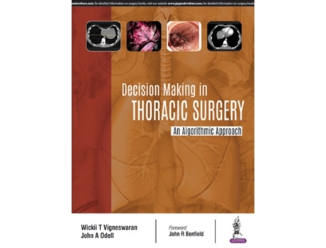 Livro decision making in thoracic surgery de wickii t vigneswaran,john odell (inglês)