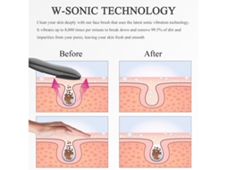 Escova De Limpeza Facial Sônica 2 Em 1 Escova Esfoliante E Massageadora De Silicone Para Homens Mulheres E Adolescentes Escova Elétrica Para Bestvite