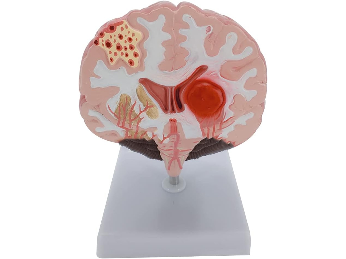 Modelo Anatômico Humano com Artérias do Córtex Cerebral para Conferências. SFUSHOS