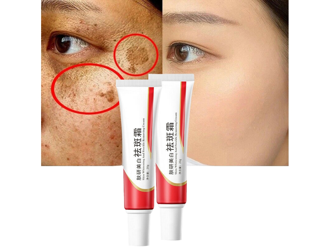 Creme De Cuidado Com A Pele Para Remover Manchas E Clarear A Cara 20g Vante