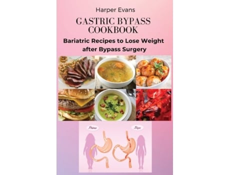 Livro Gastric Bypass Cookbook Bariatric Recipes To Lose Weight After Bypass Surgery De Harper Evans (inglês)