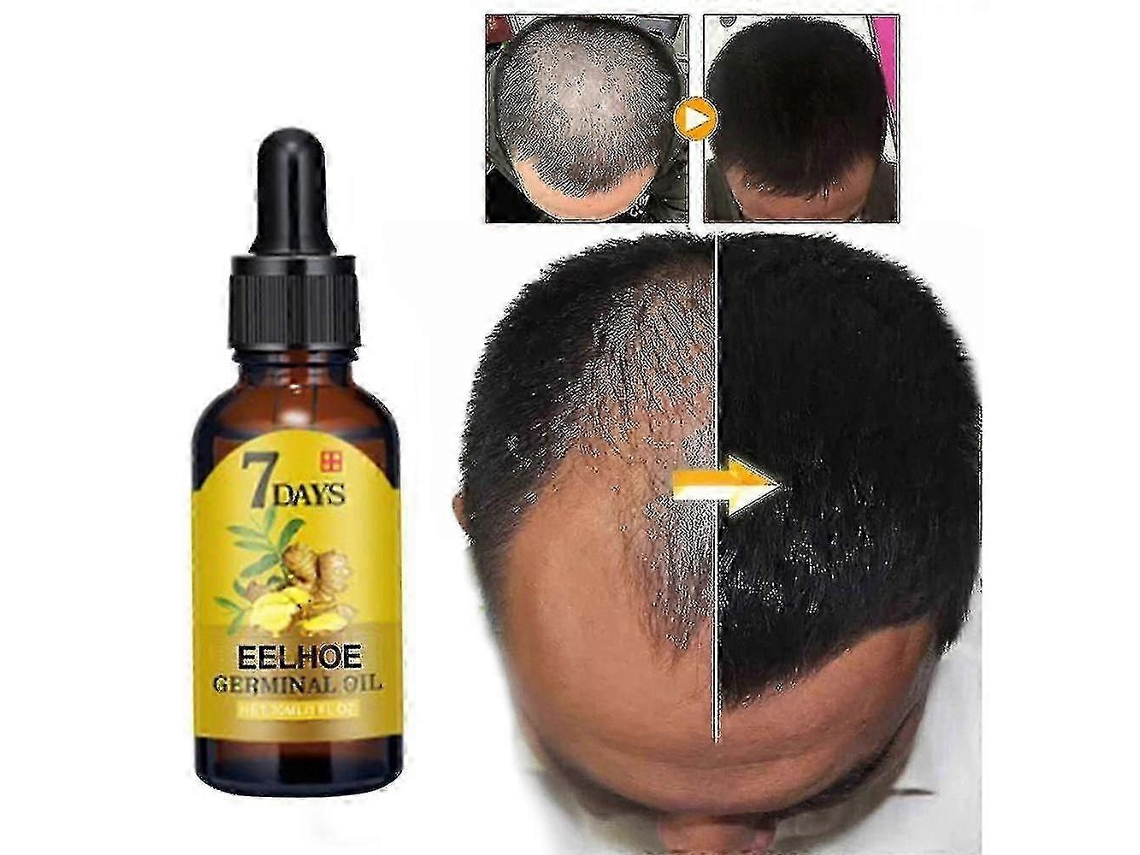 Fluido Para Crescimento Capilar Com Gengibre Eelhoe