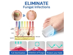 Zengo 2024 Novo Dispositivo de Limpeza Fungos Unhas, Terapia Unhas Luz Azul para Grossas Descolorida S Danificadas Das Mão GOKOCO