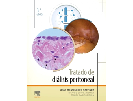 Livro Tratado De Diálisis Peritoneal de Jesús Montenegro Martínez (Español)