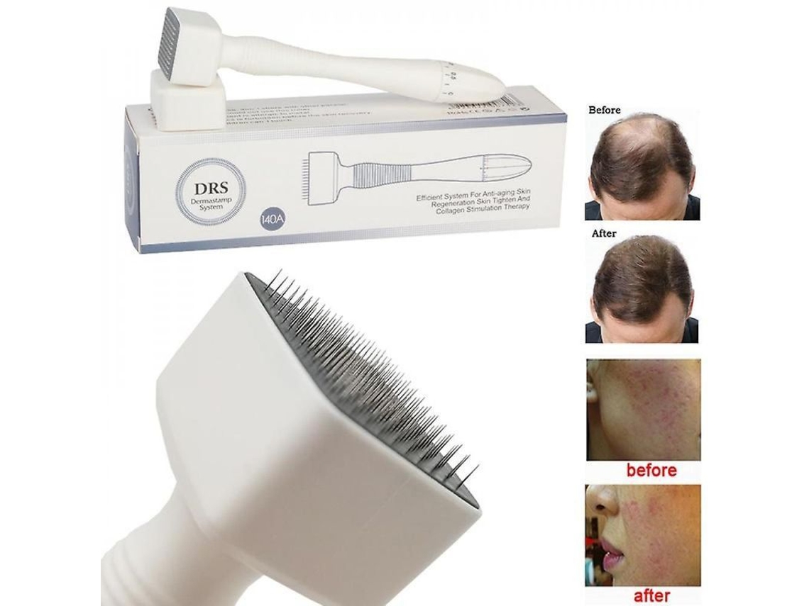Estampa Derma 140a Com Comprimento De Agulha Ajustável Para Crescimento Capilar E Barba