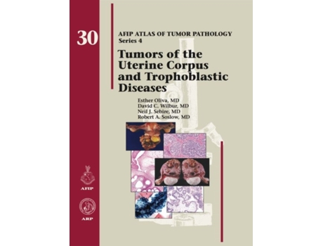 Livro tumors of the uterine corpus and trophoblastic diseases de esther oliva,david c. wilbur,neil j. sebire (inglês)