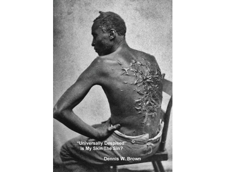 Livro Quotuniversally Despisedquot Is My Skin The Sin? De Dennis Brown (inglês)
