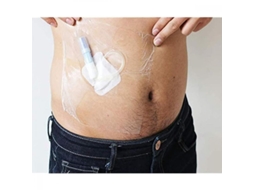 Curativos transparentes e impermeáveis para feridas, 10x10cm, descartáveis, higiênicos, película protetora, 50 unidades.