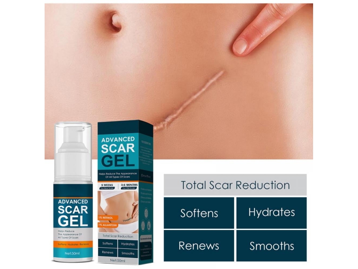 Creme para cicatrizes de cesárea, estrias, acne e cirurgias. Eficaz tanto para cicatrizes antigas quanto recentes.
