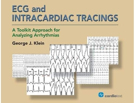 Livro ECG and Intracardiac Tracings A Toolkit Approach for Analyzing Arrhythmias de George J Klein Md (Inglês)