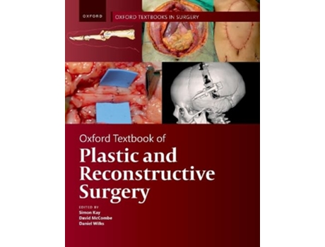 Livro Oxford Textbook of Plastic and Reconstructive Surgery de Simon Kay, Daniel Wilks et al. (Inglês)