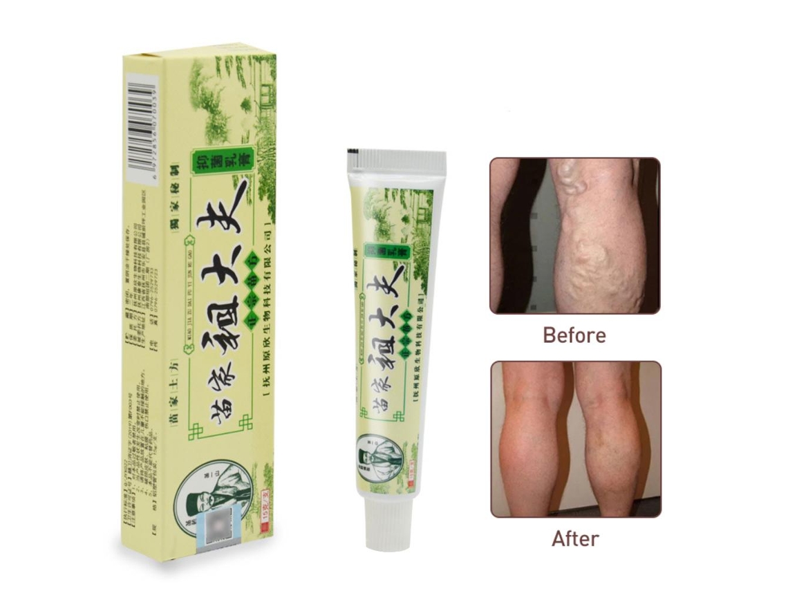 Crema Para Cuidado Da Psoríase Cutânea, Dermatite E Eczema