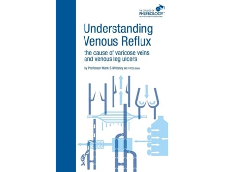 Livro Understanding Venous Reflux The Cause Of Varicose Veins And Venous Leg Ulcers De Mark S Whiteley (inglês)