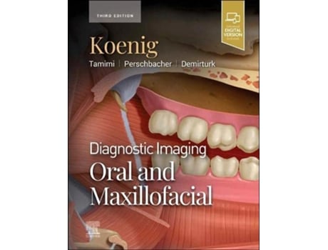 Livro Diagnostic Imaging Oral and Maxillofacial de Lisa J Koenig Bchd Dds Ms, Dania Tamimi Bds Dmsc et al. (Inglês - Capa Dura)