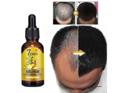 Fluido Para Crescimento Capilar Com Gengibre Eelhoe