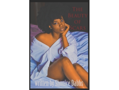 Livro The Beauty of Scars Shonice Dabbs, Shonice Dabbs (Inglês)