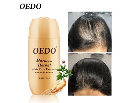Ervas Marroquinas Essência De Crescimento Capilar Anti Perda De Cabelo Para Homens E Mulheres Reparação Capilar Rápida E Poderosa Oedo