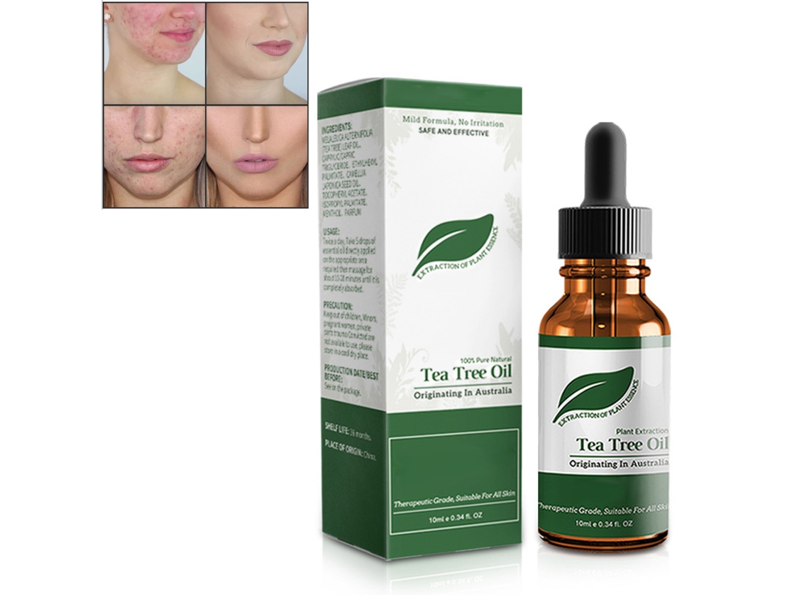 Óleo essencial de melaleuca para hidratar a pele com tendência a acne, controlar a oleosidade e minimizar os poros.