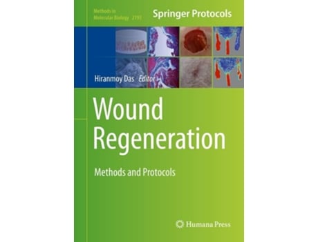 Livro Wound Regeneration De Hiranmoy Das (inglês - Capa Dura)