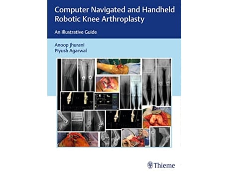 Livro Computer Navigated and Handheld Robotic Knee Arthroplasty de Anoop Jhurani e Piyush Agarwal (Inglês - Capa Dura)