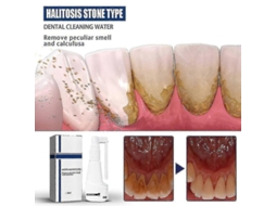 Spray De Solvente De Sarro Dental, Blanqueador Instantâneo, Limpeza Profunda, Remoção De Manchas, Fresco