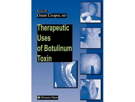 Livro Therapeutic Uses of Botulinum Toxin de Humana Press (Inglês)