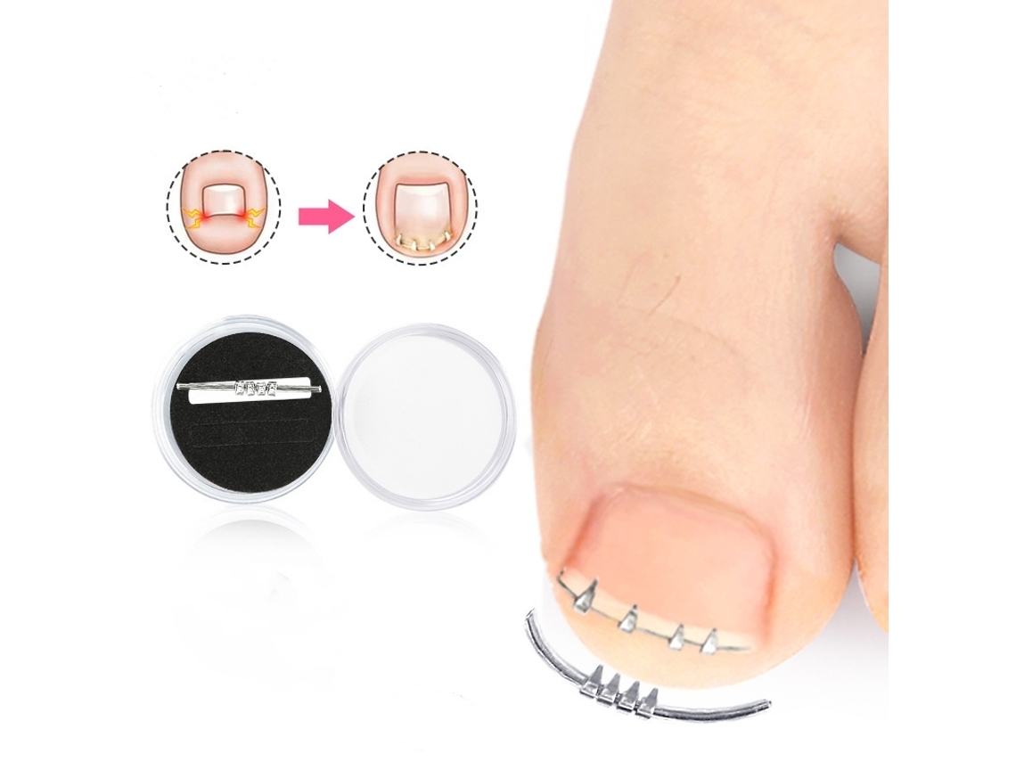 Corretor Para Unhas Encravadas Silver