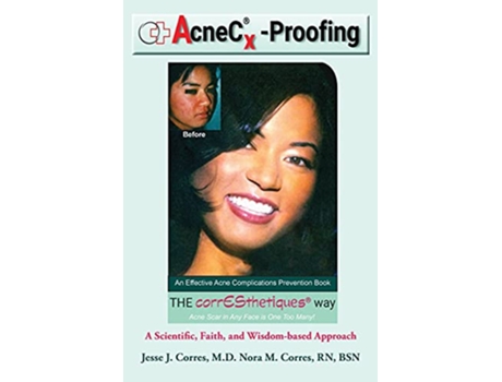 Livro AcneCRXProofing An Effective Acne Complications Prevention Book de Jesse J Corres M D (Inglês)