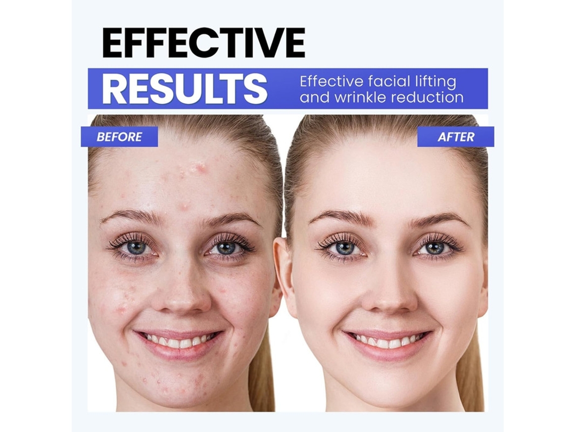 Dispositivo Facial De Microcorrente A Mais Recente Tecnologia De Luz Vermelha Recursos Aprimorados De Levantamento Facial E Endurecimento Yizhood
