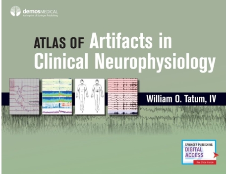 Livro artifacts in clinical neurophysiology de tatum, william o., iv (inglês)