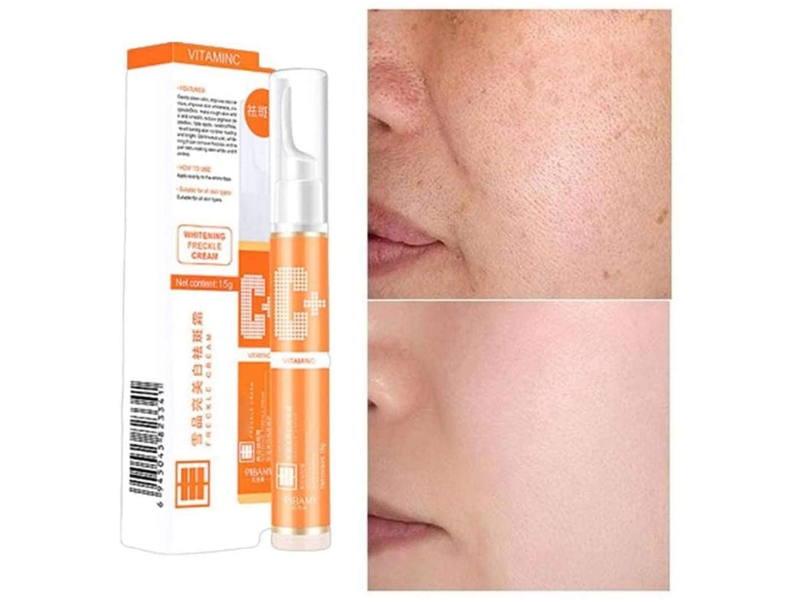 Creme De Branqueamento Para Remoção De Manchas E Clareamento Facial