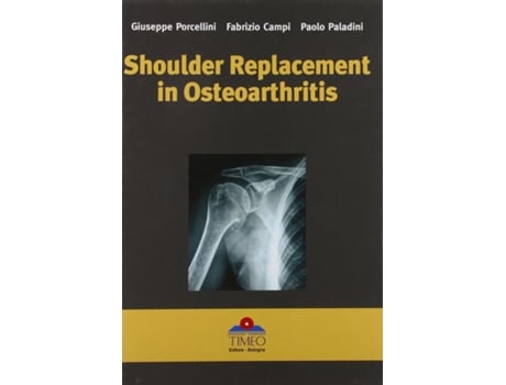 Livro Shoulder Replacement in Osteoarthritis de Fabrizio Paladini e Paolo Porcellini Giuseppe Campi (Inglês - Capa Dura)