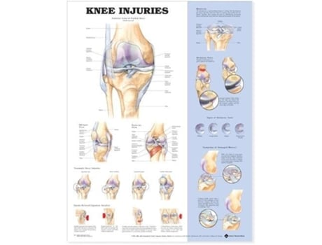 Livro Knee Injuries Anatomical Chart de Acc (Inglês)