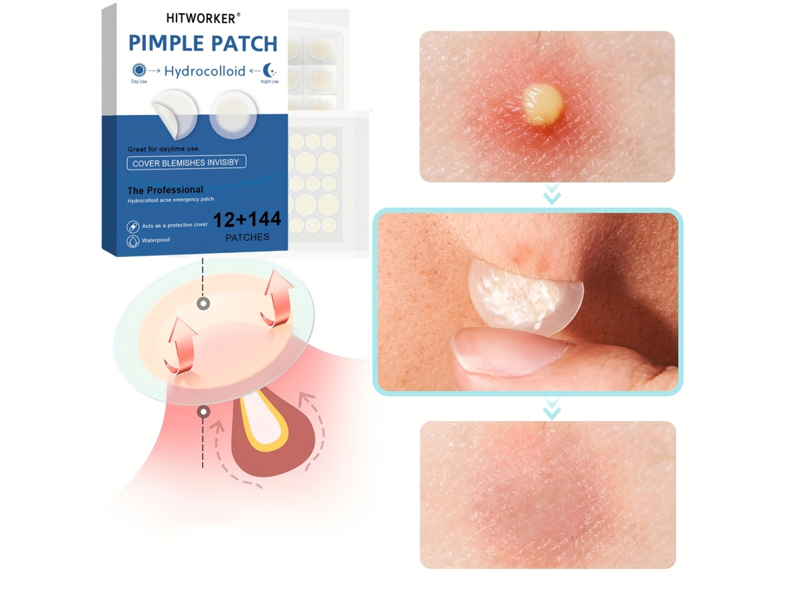 Pacote com 156 Adesivos de Gel Invisíveis, Bege, para Reduzir a Acne e Hidratar a Pele. Aderem Suavemente a Diversas Partes do Corpo. MDUG