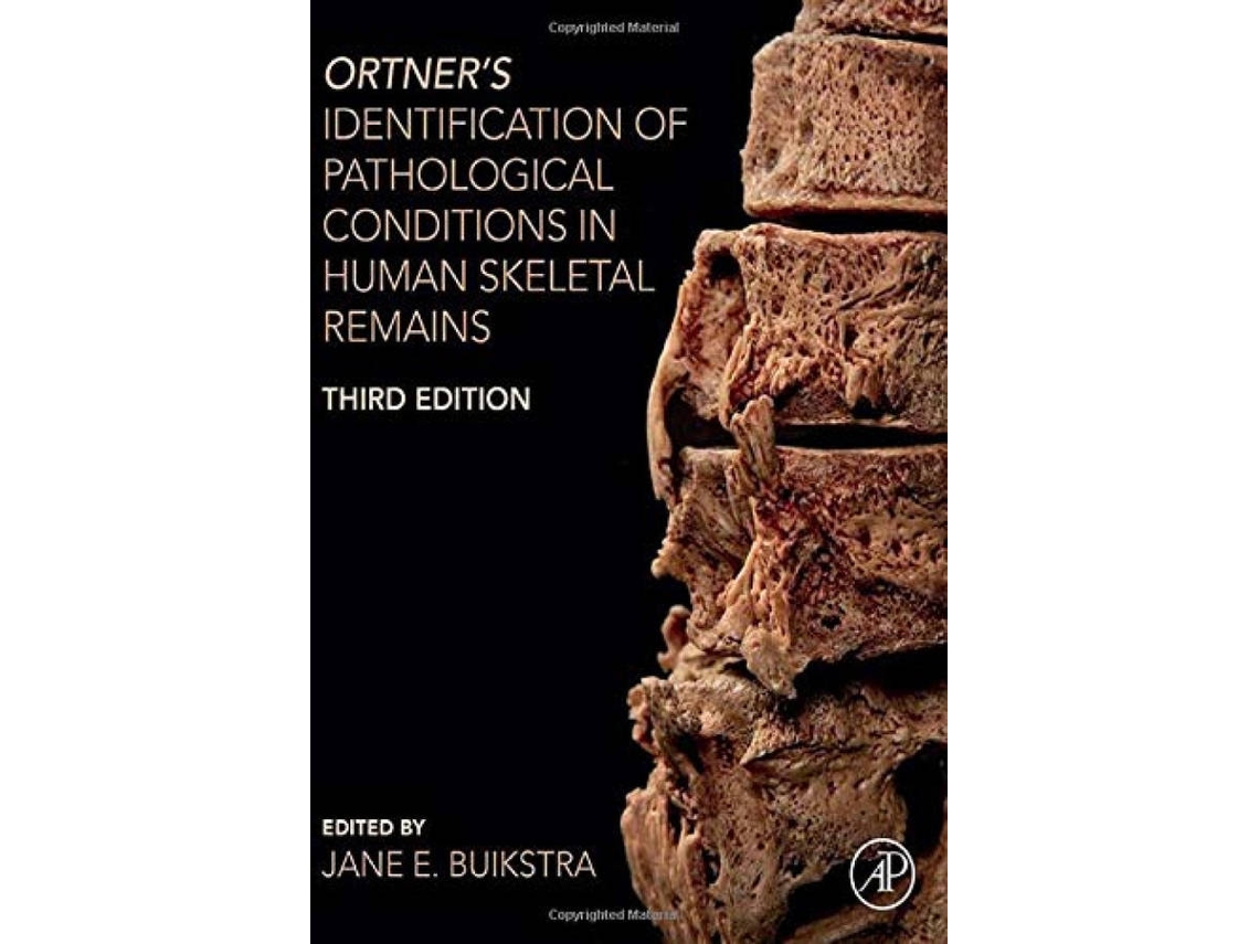 Livro Ortner´S Identification Of Pathological Conditions Human Skeletal Reimains de Buikstra (Inglês)