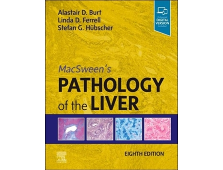 Livro MacSweens Pathology of the Liver de Alastair D Burt Bsc Mbchb Md Frcpath Frcpa Frcp Frsb Fahms, Linda D Ferrell Md et al. (Inglês - Capa Dura)