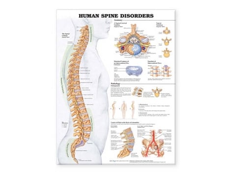 Livro human spine disorders anatomical chart de prepared for publication by anatomical chart company (inglês)