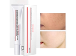 Crema Acné 20g: Elimina Rugas, Manchas E Manchas, Anti-imperfeições