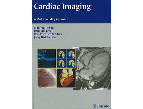 Livro Cardiac Imaging A Multimodality Approach de Manfred Thelen (Inglês)