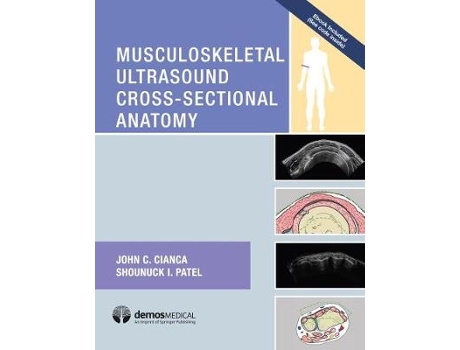 Livro Musculoskeletal Ultrasound Cross-Sectional Anatomy de John C Cianca Md e Shounuck I Patel Do (Inglês - Capa Dura)