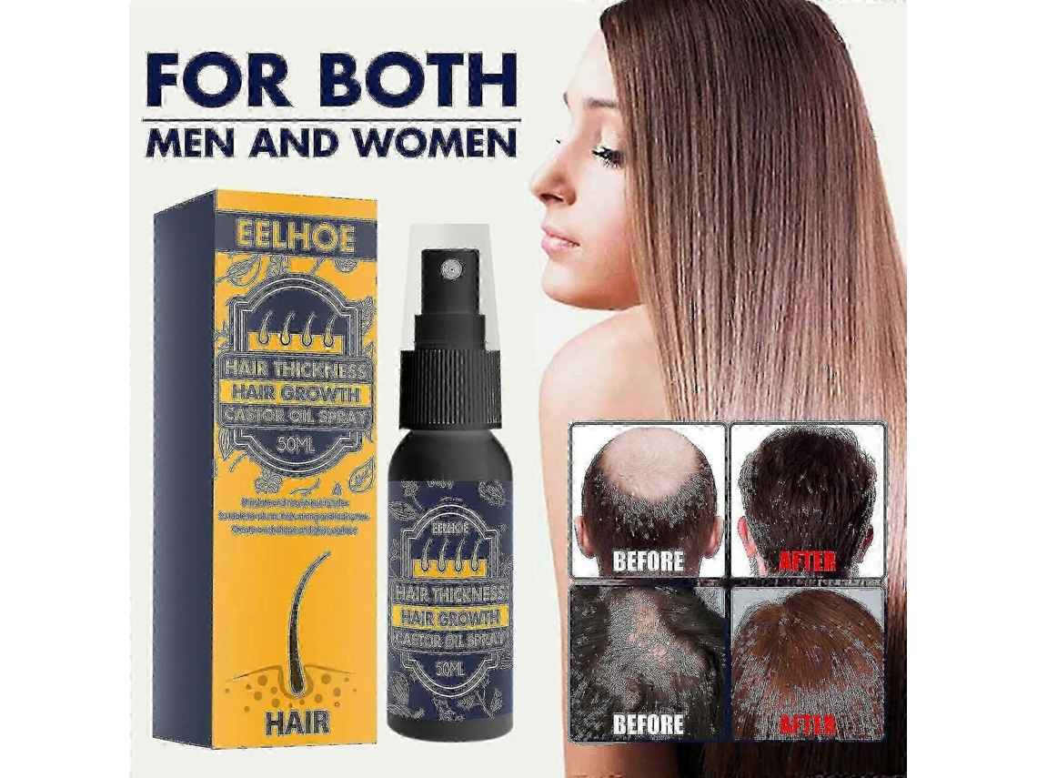 Spray Para Crescimento Capilar Com Óleo De Rícino Eelhoe