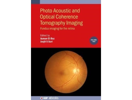 Livro Photo Acoustic and Optical Coherence Tomography Imaging: Fundus Imaging for the Retina (Volume 2) Ayman El-Baz, Jasjit S Suri (Inglês)