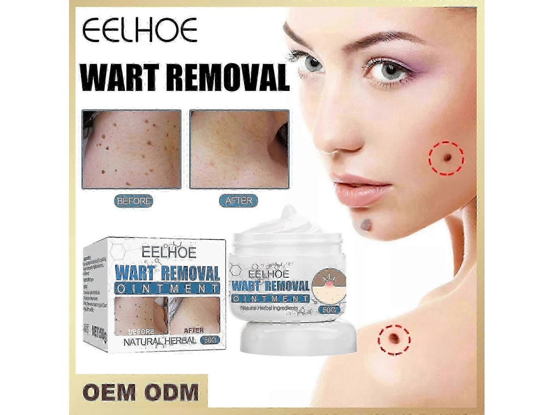 Creme Eelhoe Para Verrugas: Creme De Limpeza Facial Para Achatar Verrugas Faciais E Verrugas Filiformes.