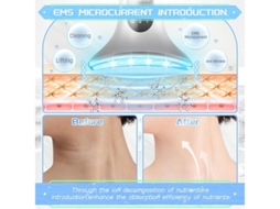 Massageador Facial 4 Modos Rejuvenescimento Térmico Led De Tripla Ação Massageador Antienvelhecimento Para Pescoço E Olhos Branco Bestvite