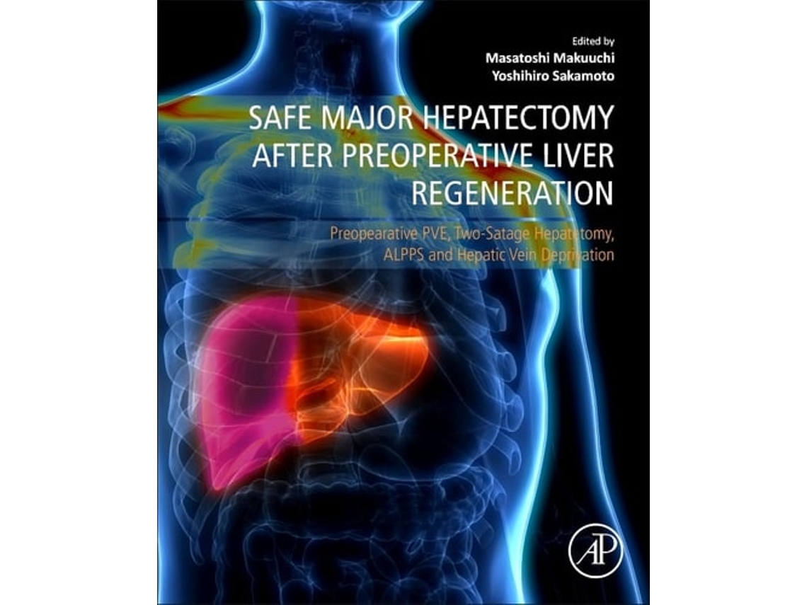 Livro Safe Major Hepatectomy After Preoperative Liver Regeneration De Yoshihiro Sakamoto E Masatoshi Makuuchi (inglês)
