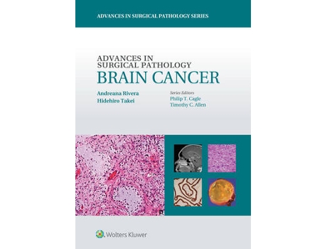 Livro advances in surgical pathology: brain cancer de andreana rivera,hidehiro takei (inglês)